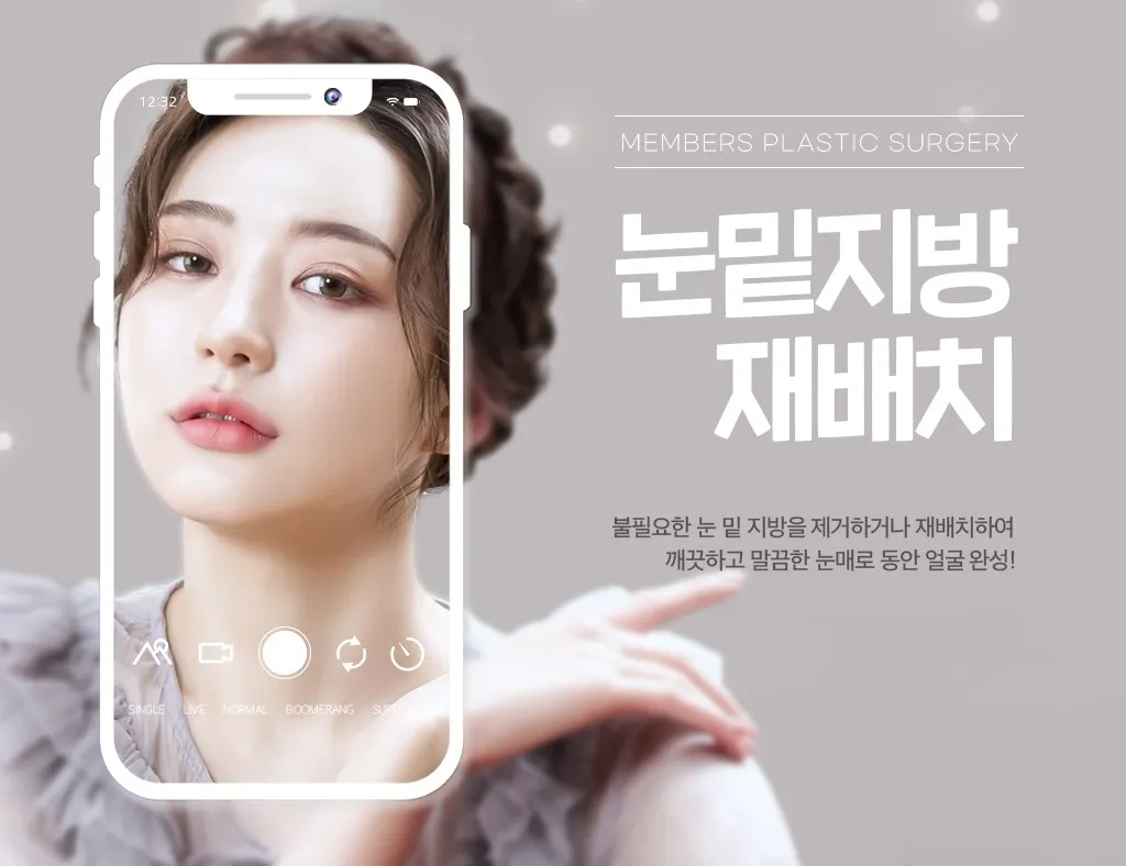 눈밑지방재배치 수술